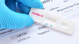 В управлении здравоохранения объяснили долгую выдачу анализов на коронавирус
