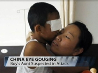 Китайский врач решил подарить мальчику бионические глаза