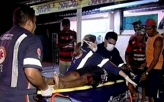 Житель Бразилии добрался после драки до больницы с ножом в голове