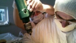 В Молдавии хирурги оперировали детей строительными инструментами
