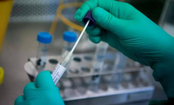 В управлении здравоохранения Павлодарской области сообщили о двух новых случаях заражения коронавирусной инфекцией