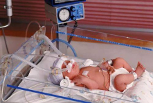 Четверым недоношенным новорожденным в Павлодарской области потребовалась срочная помощь врачей