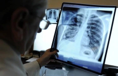 В Литве учительница заразила туберкулезом 77 школьников