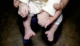 В Китае ребенок родился с 31 пальцем (фото)