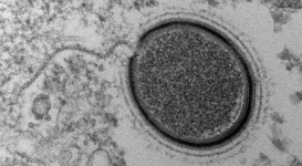 Ученые "воскресят" 30000-летний гигантский вирус