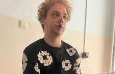 Три выбитых зуба и перелом челюсти: павлодарец попал в больницу, упав с электросамоката